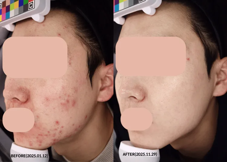 확실한 효과를 내겠습니다.