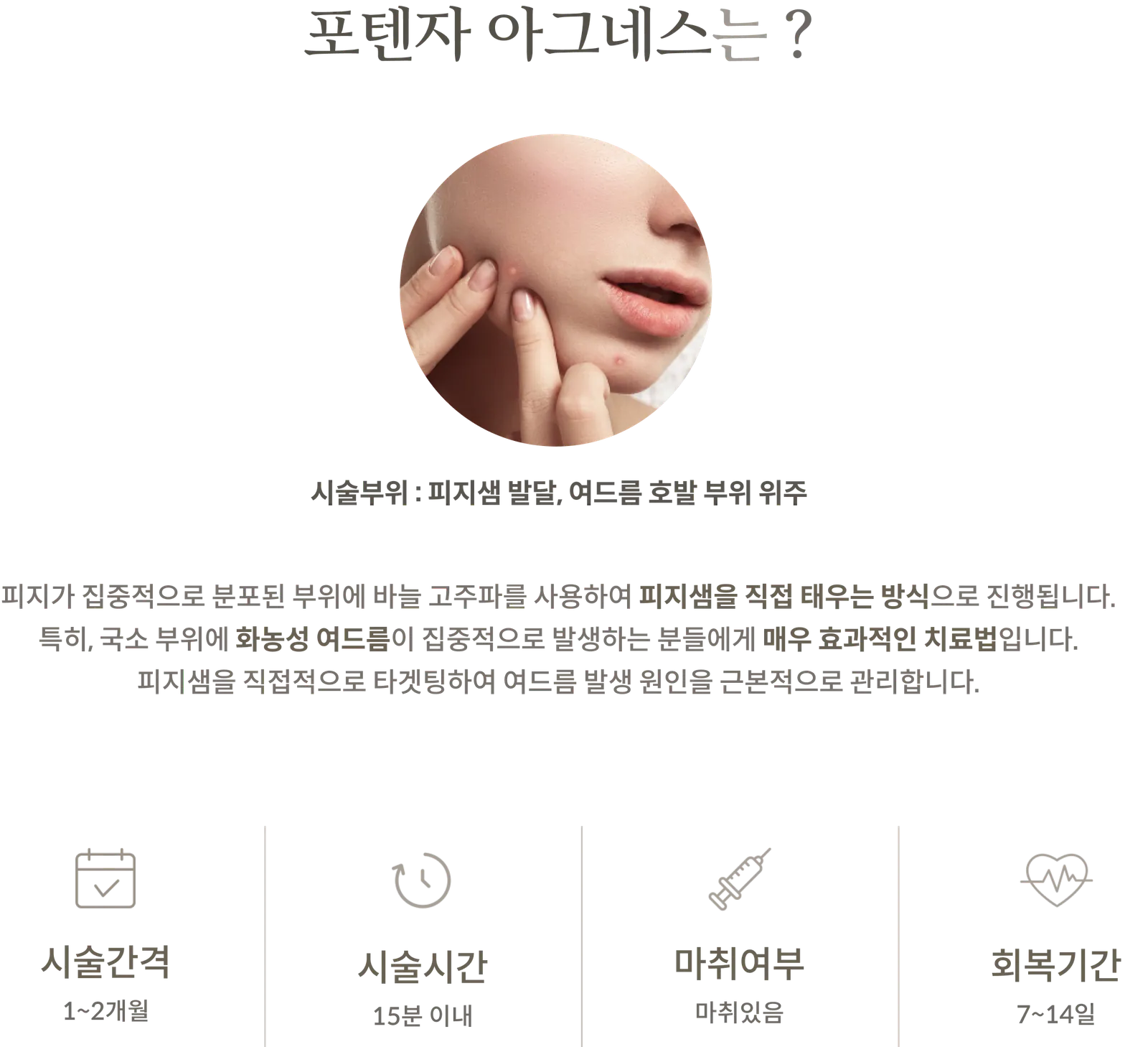 포텐자 아그네스 시술 정보 패널: 시술부위 피지샘 발달, 여드름 호발 부위 위주, 바늘 고주파로 피지샘을 직접 태우는 방식 설명, 시술간격 1~2개월, 시술시간 15분 이내, 마취있음, 회복기간 7~14일
