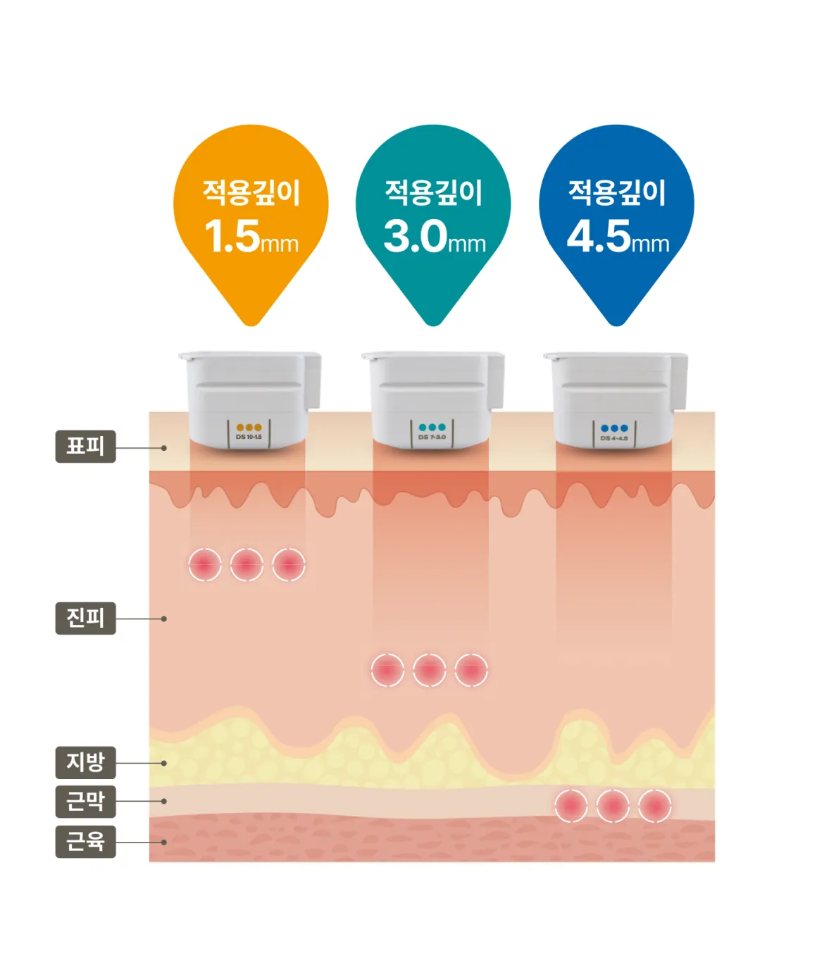 적용 깊이별 3가지 팁 다이어그램