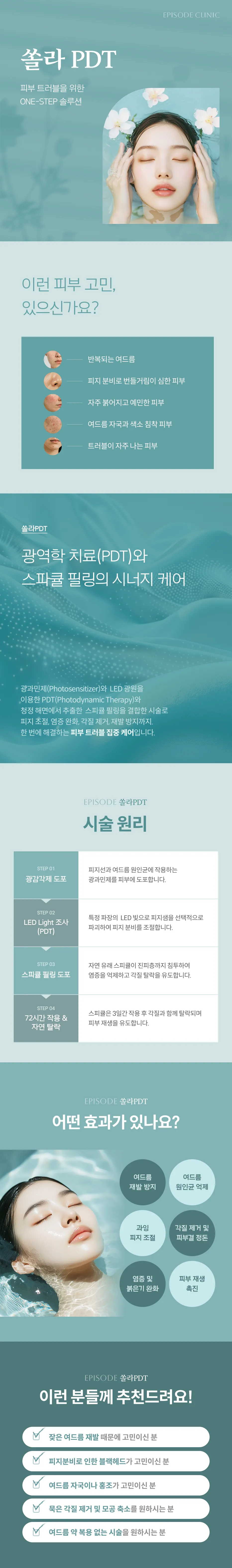 쏠라 PDT 상세 안내: 피부 고민 5가지, PDT와 스피큘 필링 결합 설명, 시술 원리 4단계(광감각제 도포, LED 조사, 스피큘 필링, 72시간 작용 후 탈락), 효과 6가지, 대상 안내 5가지