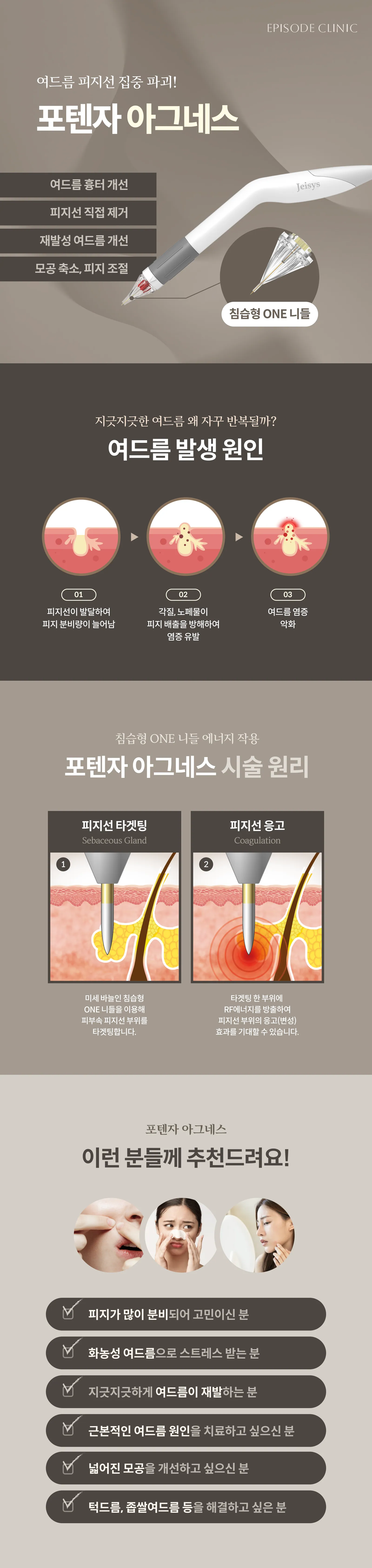 포텐자 아그네스 상세 안내: 침습형 ONE 니들 장비 사진, 적용 4가지, 여드름 발생 원인 3단계, 시술 원리 2단계(피지선 타겟팅, 피지선 응고), 대상 안내 6가지