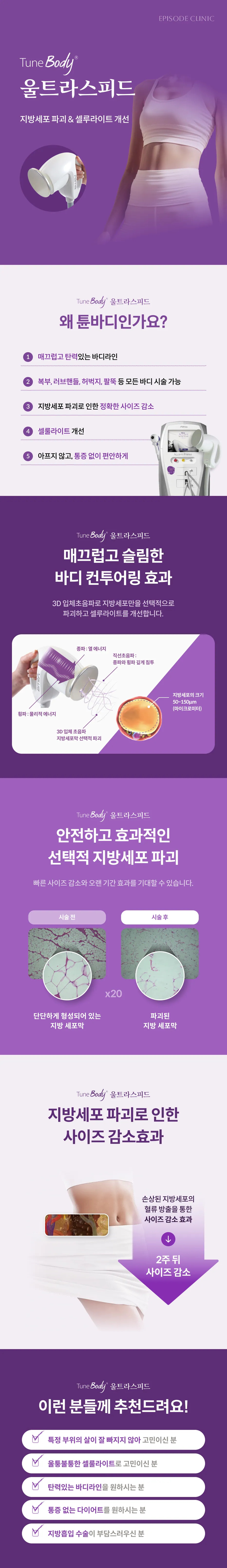 튠바디 울트라스피드 상세 안내: 지방세포 파괴와 셀룰라이트 관리, 튠바디인 이유 5가지, Alma Accent Prime 장비, 3D 입체 초음파 원리 도해, 지방 세포막 전후 조직 사진, 사이즈 감소 과정, 대상 안내