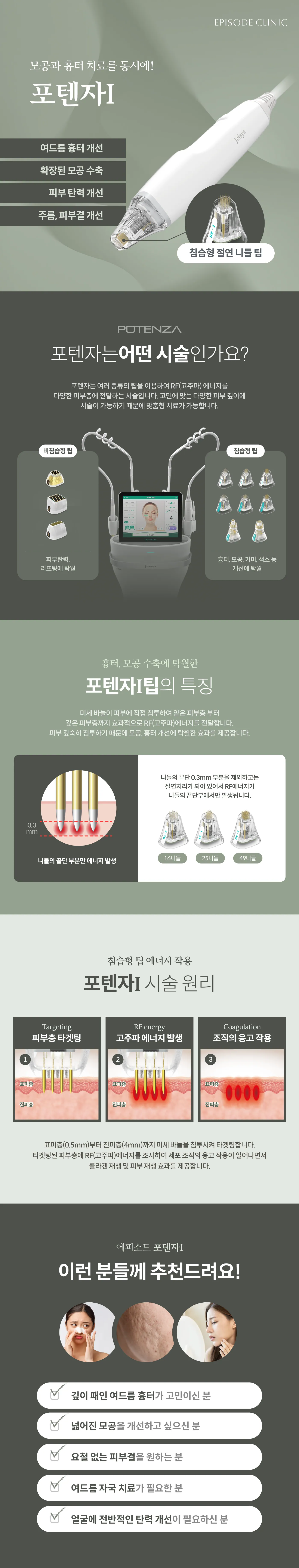 포텐자I 상세 안내: 침습형 절연 니들 팁 장비 사진, 비침습형과 침습형 팁 비교, I팁 특징(끝단 0.3mm만 에너지 발생, 16/25/49니들), 시술 원리 3단계, 대상 안내 5가지