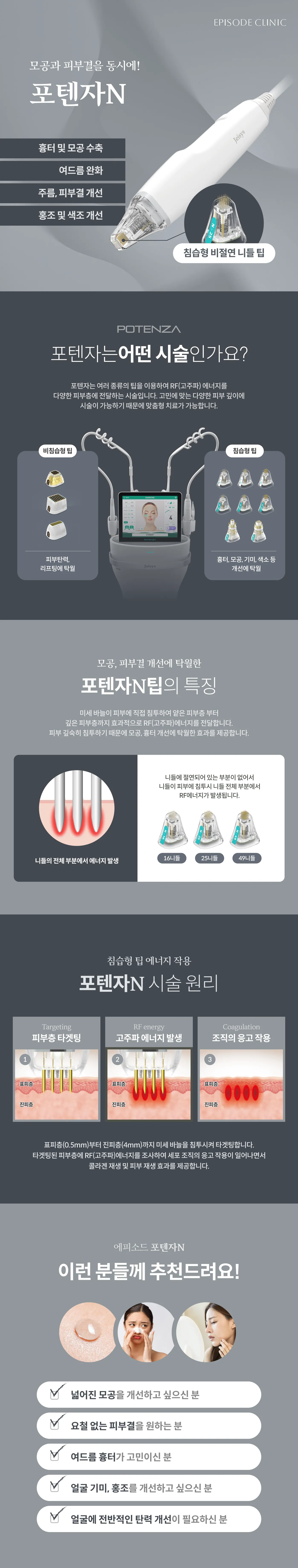 포텐자N 상세 안내: 침습형 비절연 니들 팁 장비 사진, 비침습형과 침습형 팁 비교, N팁 특징(니들 전체에서 에너지 발생, 16/25/49니들), 시술 원리 3단계, 대상 안내 5가지