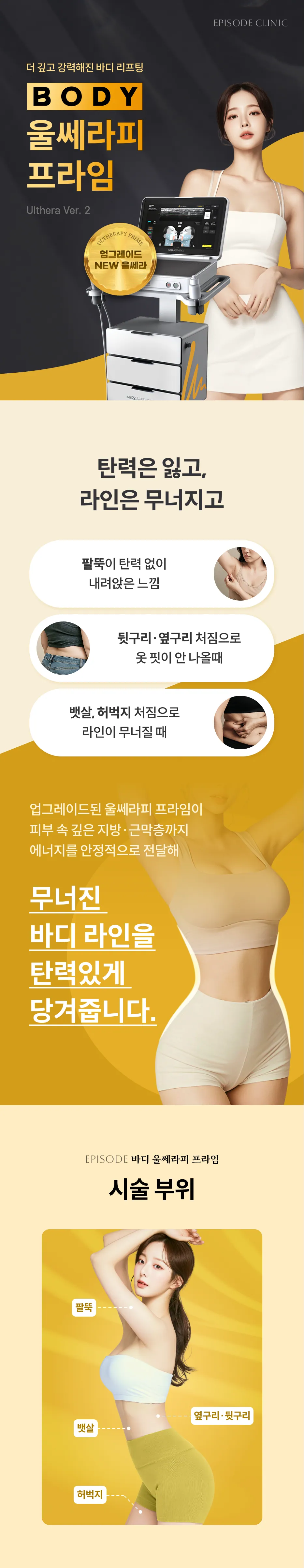 바디 울쎄라피 프라임 상세 안내: Ulthera Ver.2 업그레이드, 고민 부위(팔뚝, 뒷구리와 옆구리, 뱃살과 허벅지 처짐), 시술 부위 도해(팔뚝, 옆구리 뒷구리, 뱃살, 허벅지)