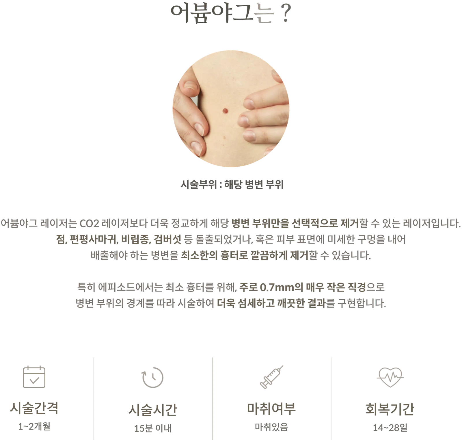 어븀야그 시술 정보 패널: 시술부위 해당 병변 부위, 시술간격 1~2개월, 시술시간 15분 이내, 마취 있음, 회복기간 14~28일