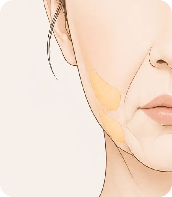 이중턱과 처짐, 주름 발생
