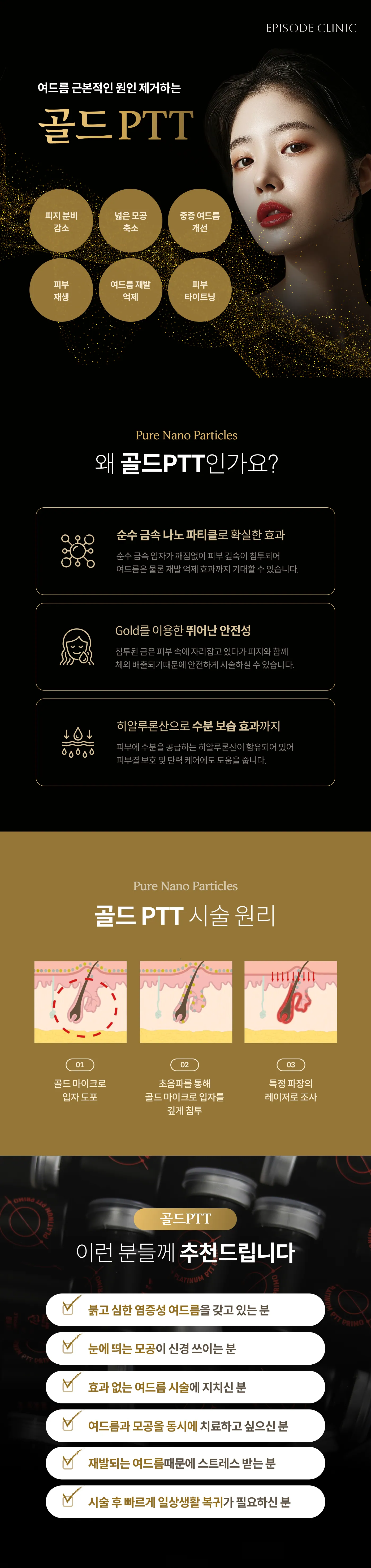 골드PTT 상세 안내: 적용 항목 6가지, 순수 금속 나노 파티클과 히알루론산 설명, 시술 원리 3단계(골드 입자 도포, 초음파 침투, 레이저 조사), 대상 안내 6가지